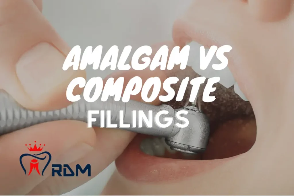 dental amalgam vs composite fillings